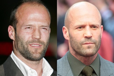 Những nam diễn viên đẹp trai hơn với kiểu “đầu trọc”