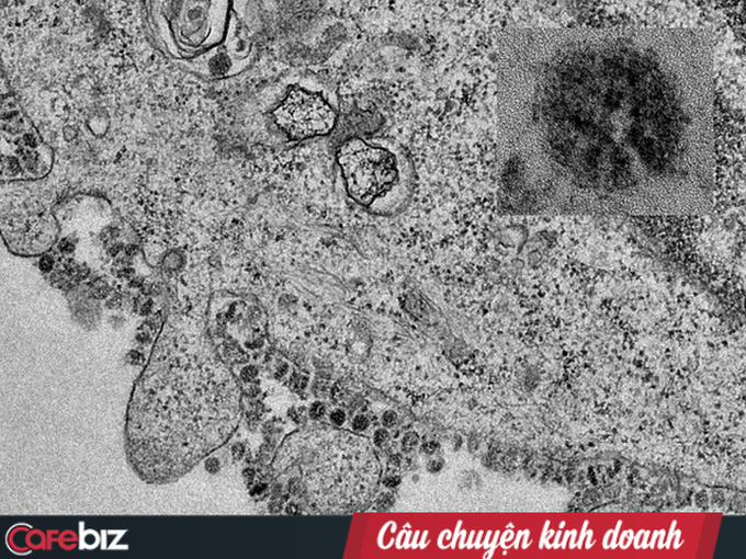 Bác sĩ BV Chợ Rẫy giải đáp về Virus corona: Lây nhiễm theo cơ chế nào? Qua đường không khí hay đường ăn uống? Vì sao gia đình 3 người Trung Quốc cùng sang Việt Nam mà chỉ 2 cha con nhiễm, còn người mẹ thì không? - Ảnh 2.