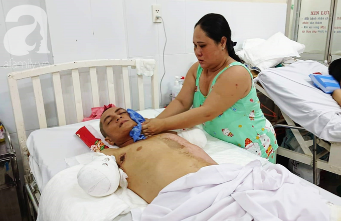 Đi làm nuôi mẹ già bị tai biến, chồng bị điện giật phải cắt 2 tay, vợ và 4 con đau đớn gom góp tiền cứu bố - Ảnh 6.