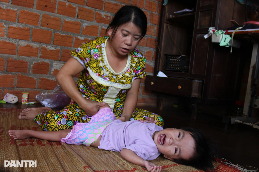 3 con bị xương thủy tinh, bố muốn mua hộp sữa cho con cũng... đắn đo - 4 3 con bị xương thủy tinh, bố muốn mua hộp sữa cho con cũng... đắn đo - 4