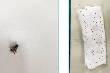 Ong đốt hơn 100 nốt, người đàn ông sốc phản vệ nguy kịch