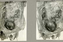 Phát hiện xác ướp thiếu nữ Ai Cập cổ đại chết khi sinh song thai