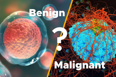 U lành tính có chữa được không?