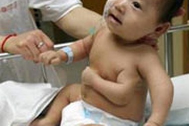 Cậu bé Trung Quốc có 3 cánh tay