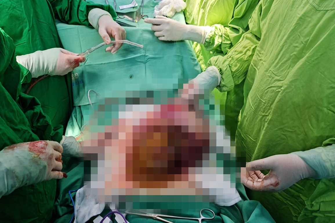 Người đàn ông không hút thuốc bất ngờ phát hiện ung thư phổi giai đoạn 4 - 1 Người đàn ông không hút thuốc bất ngờ phát hiện ung thư phổi giai đoạn 4 - 1