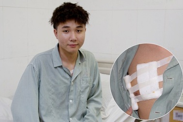 Hà Nội: Nam sinh 17 tuổi dũng cảm bắt cướp giúp bạn bị đâm rách phổi