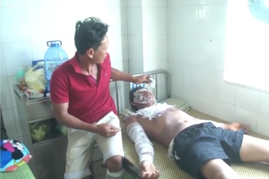 Tàu cá 6 tỷ đồng cháy rụi, 1 ngư dân bỏng nặng