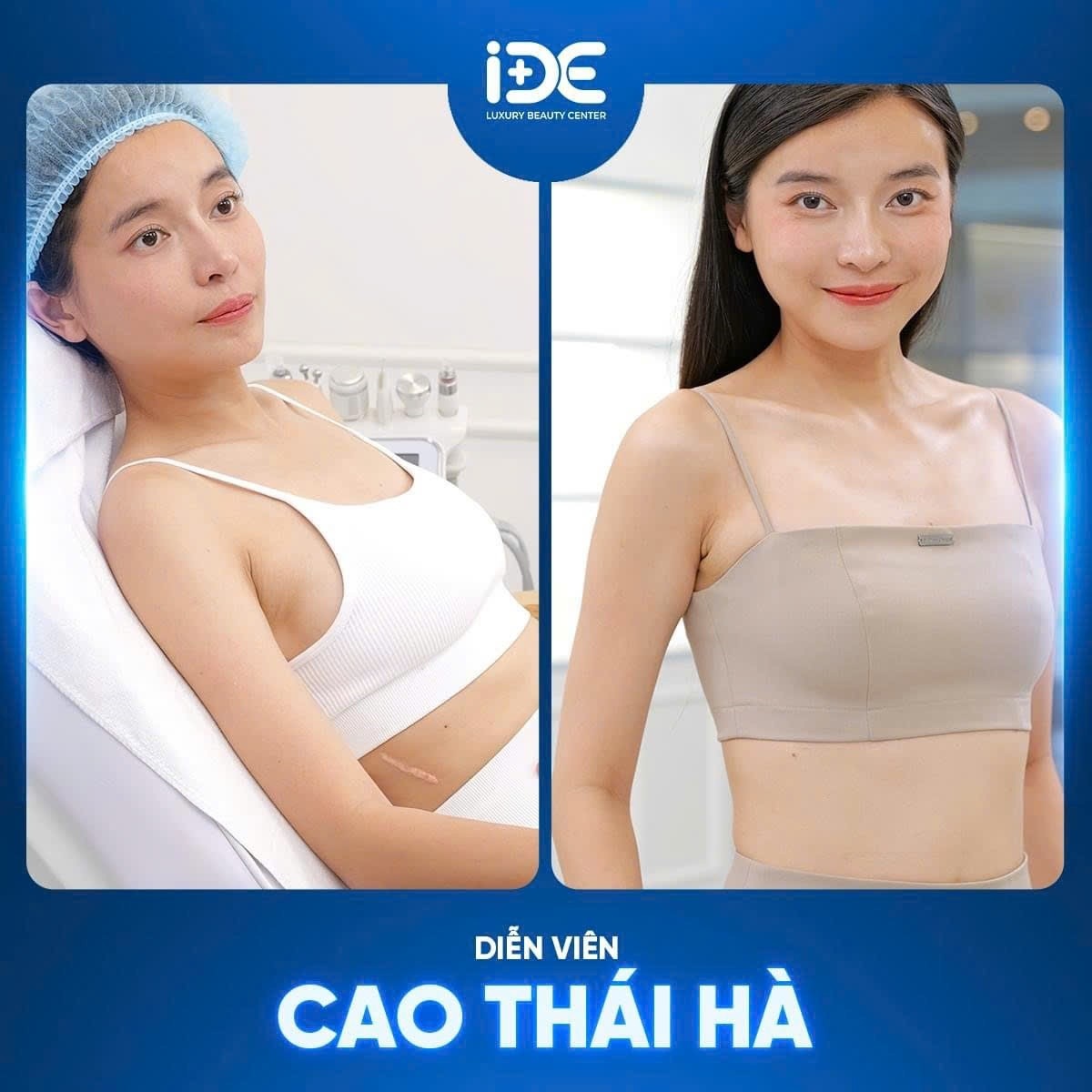 Phòng khám IDE chuyên điều trị sẹo dành cho phụ nữ - 4