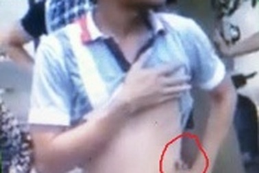 Điều chuyển CSGT bắn người vi phạm xuống làm công an phường