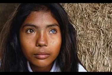 Cô gái Việt mang hai màu mắt kỳ lạ ở Ninh Thuận