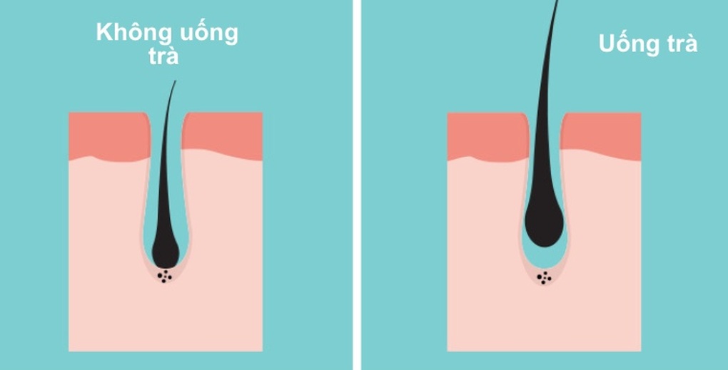 Điều gì xảy ra nếu bạn uống 4 tách trà mỗi ngày? - 2 Điều gì xảy ra nếu bạn uống 4 tách trà mỗi ngày? - 2