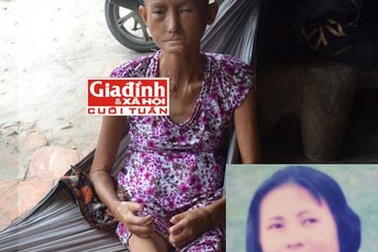 Căn bệnh kỳ lạ biến “hoa khôi” miệt vườn sau một đêm hóa thành… bà lão