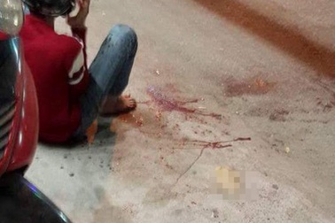 Truy sát như phim hành động ở Sài Gòn, nam thanh niên bị chém rớt tay