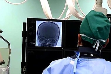 Bé 8 tuổi bị chảy máu nướu răng thường xuyên suốt 6 năm