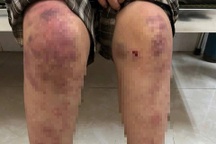 Vụ bé gái ở Thái Nguyên bị bà nội tra khảo, hành hạ: 4 tiếng "địa ngục"