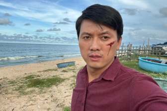 Quách Ngọc Tuyên gặp tai nạn giao thông, sức khỏe hiện ra sao?