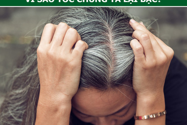 Bạc tóc vì căng thẳng, buồn phiền là hoàn toàn có thật