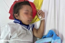 Theo bố mẹ lên rẫy, bé gái bị ong đốt 200 vết trên cơ thể