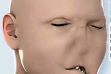 Các bước trong ca phẫu thuật ghép toàn bộ gương mặt 