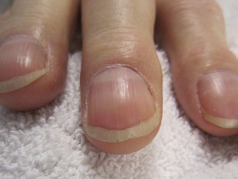 Năm triệu chứng của ung thư phổi rất nhiều người không biết - 1