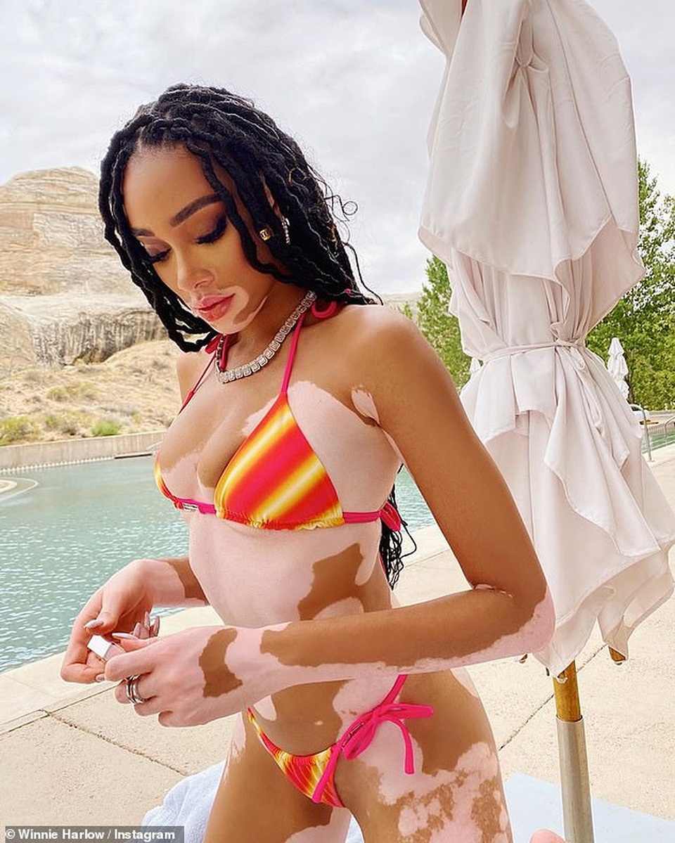 Winnie Harlow diện áo tắm bốc lửa - 8 Winnie Harlow diện áo tắm bốc lửa - 8