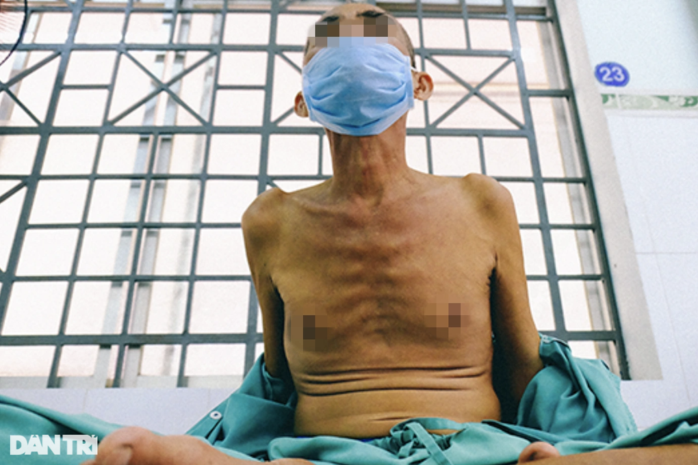 10 sự thật đáng sợ về căn bệnh hiểm hàng trăm nghìn người Việt mắc mỗi năm - 1 10 sự thật đáng sợ về căn bệnh hiểm hàng trăm nghìn người Việt mắc mỗi năm - 1