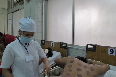 Giác hơi, mẹ vô ý "đốt cháy" con