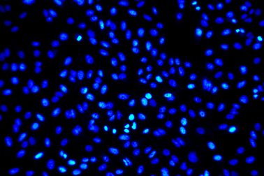 Phương pháp điều trị mới: Đưa chất độc vào thẳng tế bào ung thư