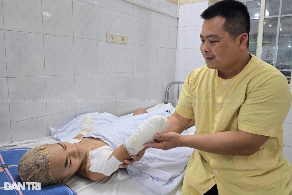 Bác sĩ kêu gọi giúp cậu bé lớp 9 bị cắt cụt 2 tay và 1 chân vì bỏng điện - 5 Bác sĩ kêu gọi giúp cậu bé lớp 9 bị cắt cụt 2 tay và 1 chân vì bỏng điện - 5