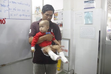 Bố hút thuốc bén lửa vào bình gas, con gái 10 tuổi bỏng nặng