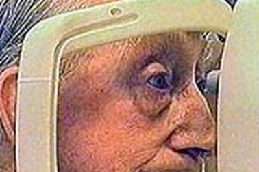 Hút thuốc lá thụ động, tăng nguy cơ mù loà 