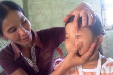 Cha ruột nhẫn tâm đánh đập con gái phải nhập viện điều trị