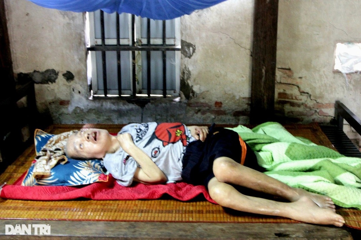 Thương người vợ còm cõi nuôi chồng và con bại não, bữa cơm nào cũng khóc - 2 Thương người vợ còm cõi nuôi chồng và con bại não, bữa cơm nào cũng khóc - 2