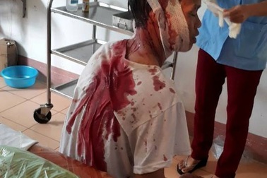 Đi lấy tiền công xây nhà, bị chủ nhà chém chí mạng