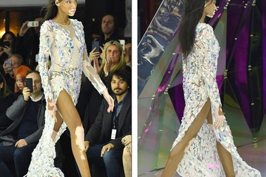 Siêu mẫu bạch biến nổi bật tại tuần lễ thời trang Milan