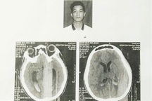 Bạc Liêu: Khởi tố một bị can vụ nam sinh bị đánh chấn thương não