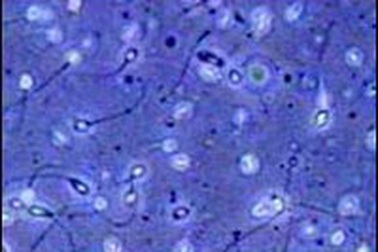 Kỹ thuật thắt ống dẫn tinh làm biến đổi gien