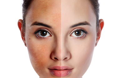 Kiểm tra lá gan khi 4 bộ phận cơ thể này chuyển màu bất thường