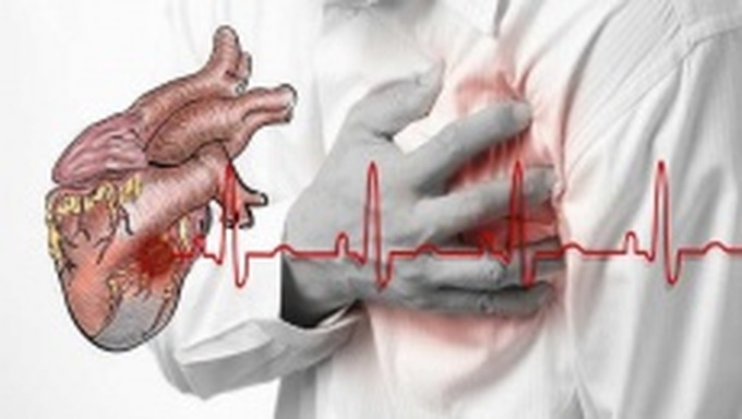 Cứu sống người đàn ông bị ngưng tim sau cơn đột ngột cảm giác mệt, tức ngực, khó thở