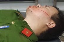 Can ngăn kẻ dọa giết người, 2 chiến sĩ công an bị chém
