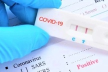 "Người dân lo mắc Covid-19 quá mức nên mua kit test bất kể giá nào"