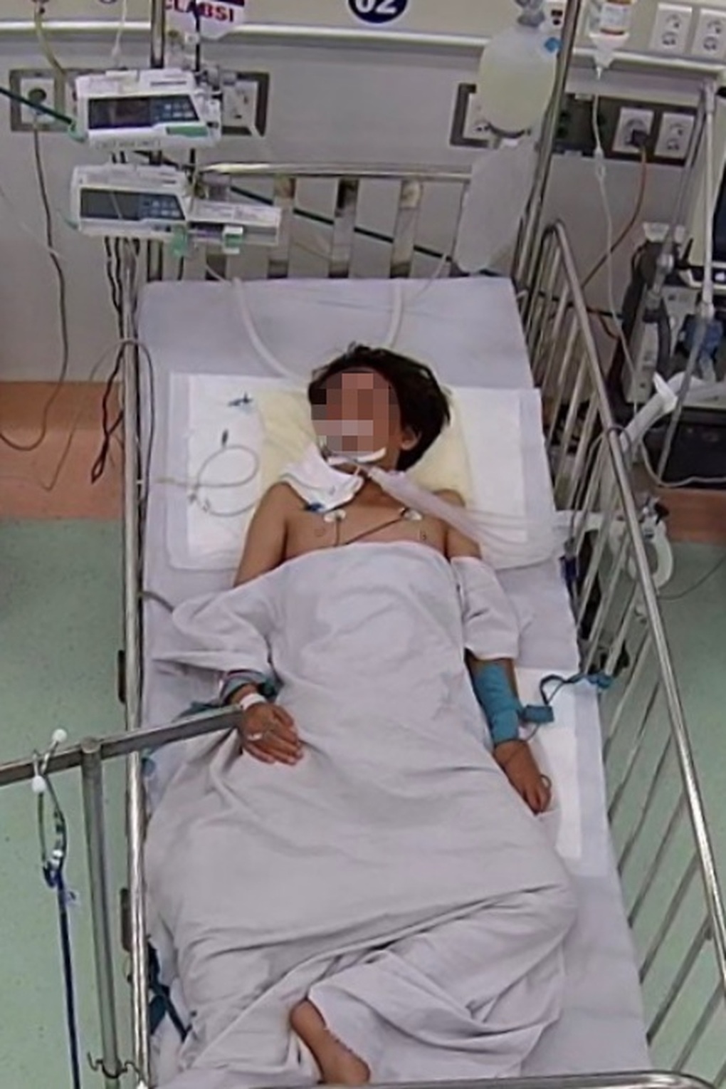 Nằm ngủ dưới nền nhà, bé trai 13 tuổi bị rắn độc dài 1 mét cắn nguy kịch - 1 Nằm ngủ dưới nền nhà, bé trai 13 tuổi bị rắn độc dài 1 mét cắn nguy kịch - 1