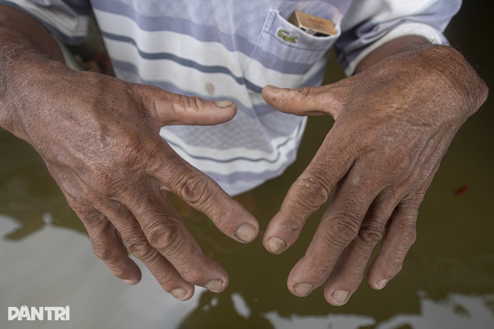 Mầm bệnh theo dòng nước bủa vây người dân tại rốn lũ Hà Nội - 13