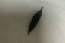 Ăn yến chưng nuốt luôn hạt táo đỏ, người phụ nữ thủng ruột