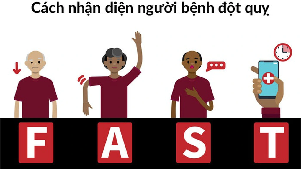 Cách nhận diện nhanh dấu hiệu người bị đột quỵ trong cộng đồng - 1 Cách nhận diện nhanh dấu hiệu người bị đột quỵ trong cộng đồng - 1