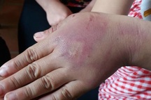 Bố mẹ giáo dục con bằng đòn roi, hãy coi chừng bị xử tù như chơi!