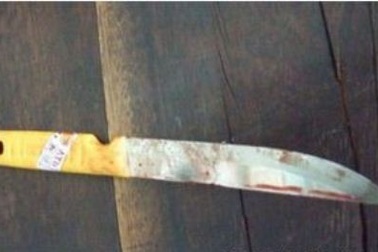 Cần Thơ: Cứu sống nữ bệnh nhân tự tử bằng dao Thái Lan