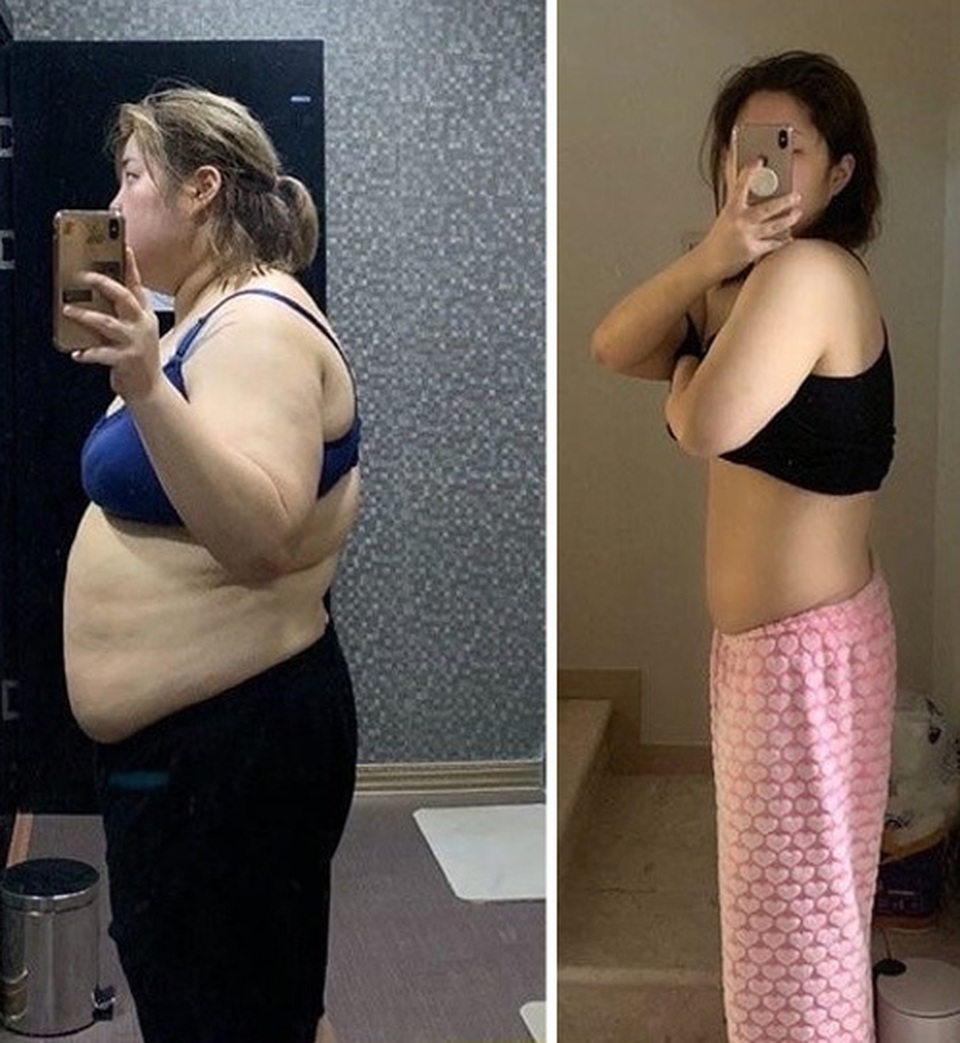 Căn bệnh ung thư phát hiện sau khi giảm cân của thánh ăn Hàn Quốc - 2 Căn bệnh ung thư phát hiện sau khi giảm cân của thánh ăn Hàn Quốc - 2