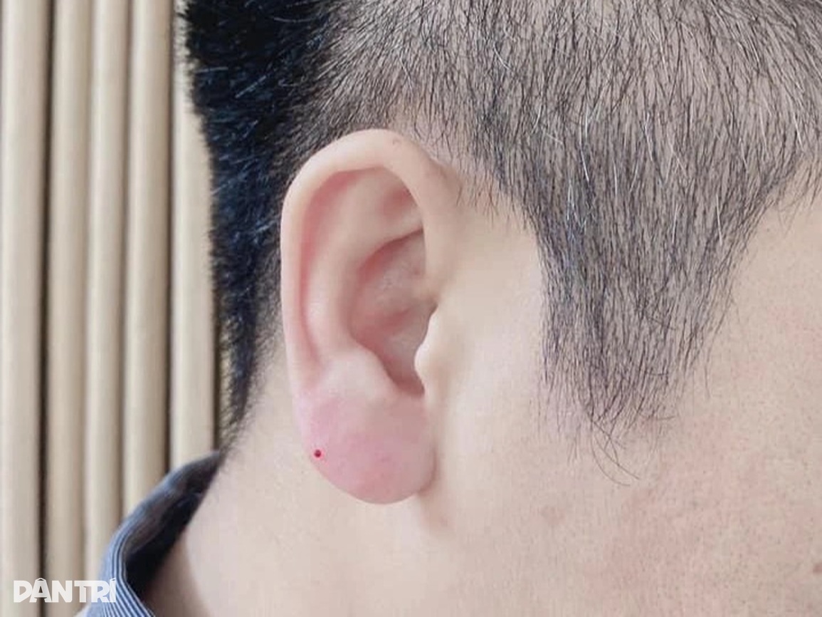 Lạ lùng trào lưu đàn ông đua nhau đi tiêm tai Phật Di Lặc - 3 Lạ lùng trào lưu đàn ông đua nhau đi tiêm tai Phật Di Lặc - 3