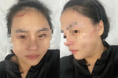 Cô gái kể lúc bị chủ nhà đánh trong quán ăn ở TPHCM